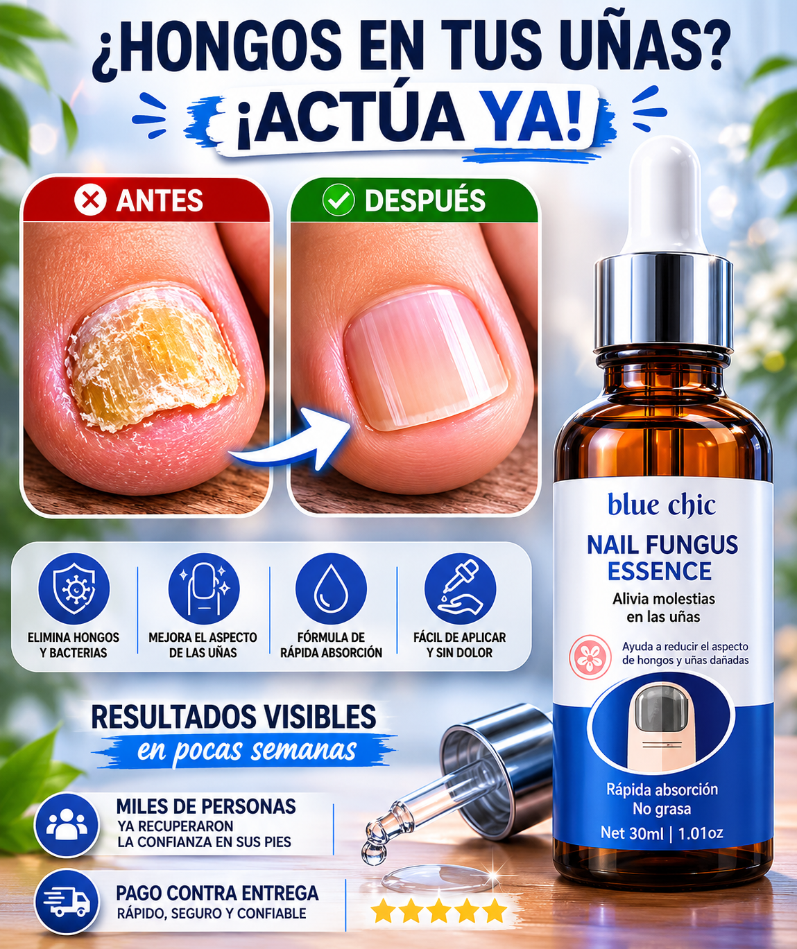 Nail Fungus Essence | Tratamiento para mejorar uñas con hongos - "Elimina los Hongos y Evita que Regresen"