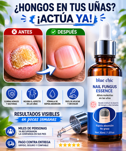 Nail Fungus Essence | Tratamiento para mejorar uñas con hongos - "Elimina los Hongos y Evita que Regresen"