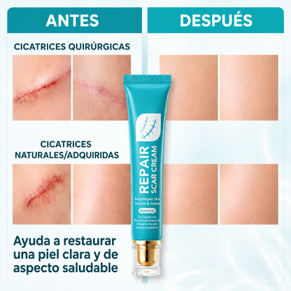 Adiós a las Cicatrices! — SADOER Repair Cream + Envío Gratis🎁