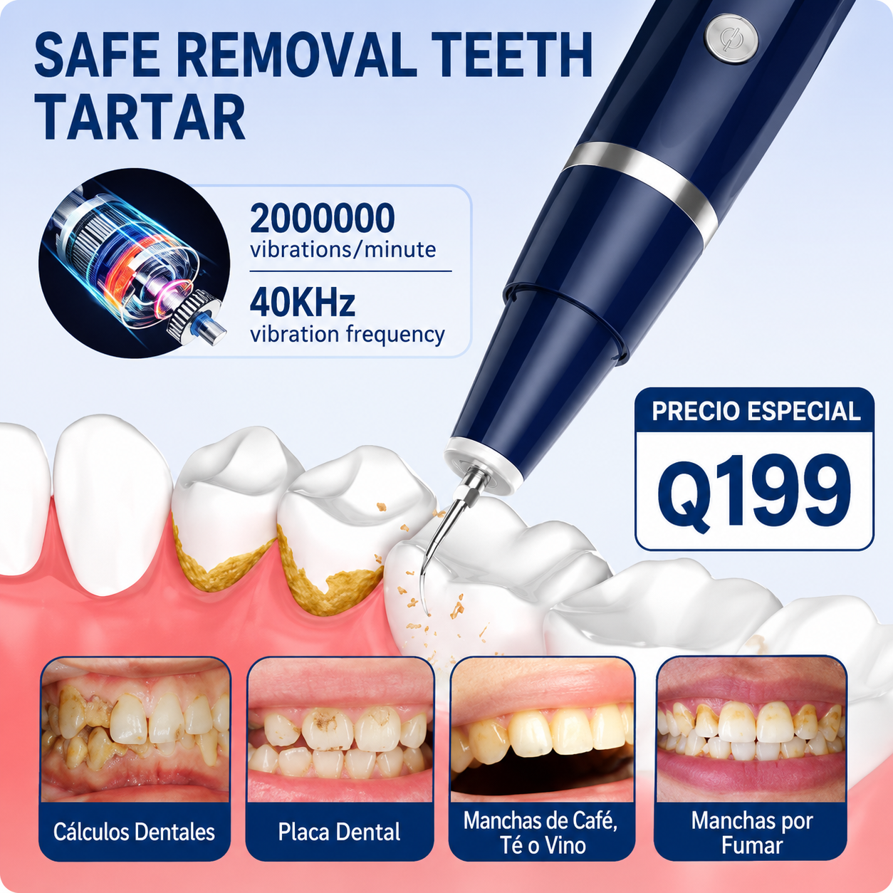 Limpiador Dental de Sarro Portátil - DentalClean Pro™