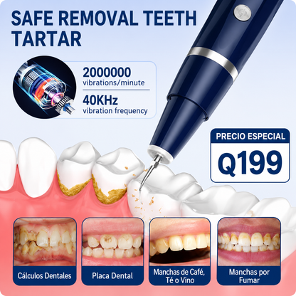 Limpiador Dental de Sarro Portátil - DentalClean Pro™
