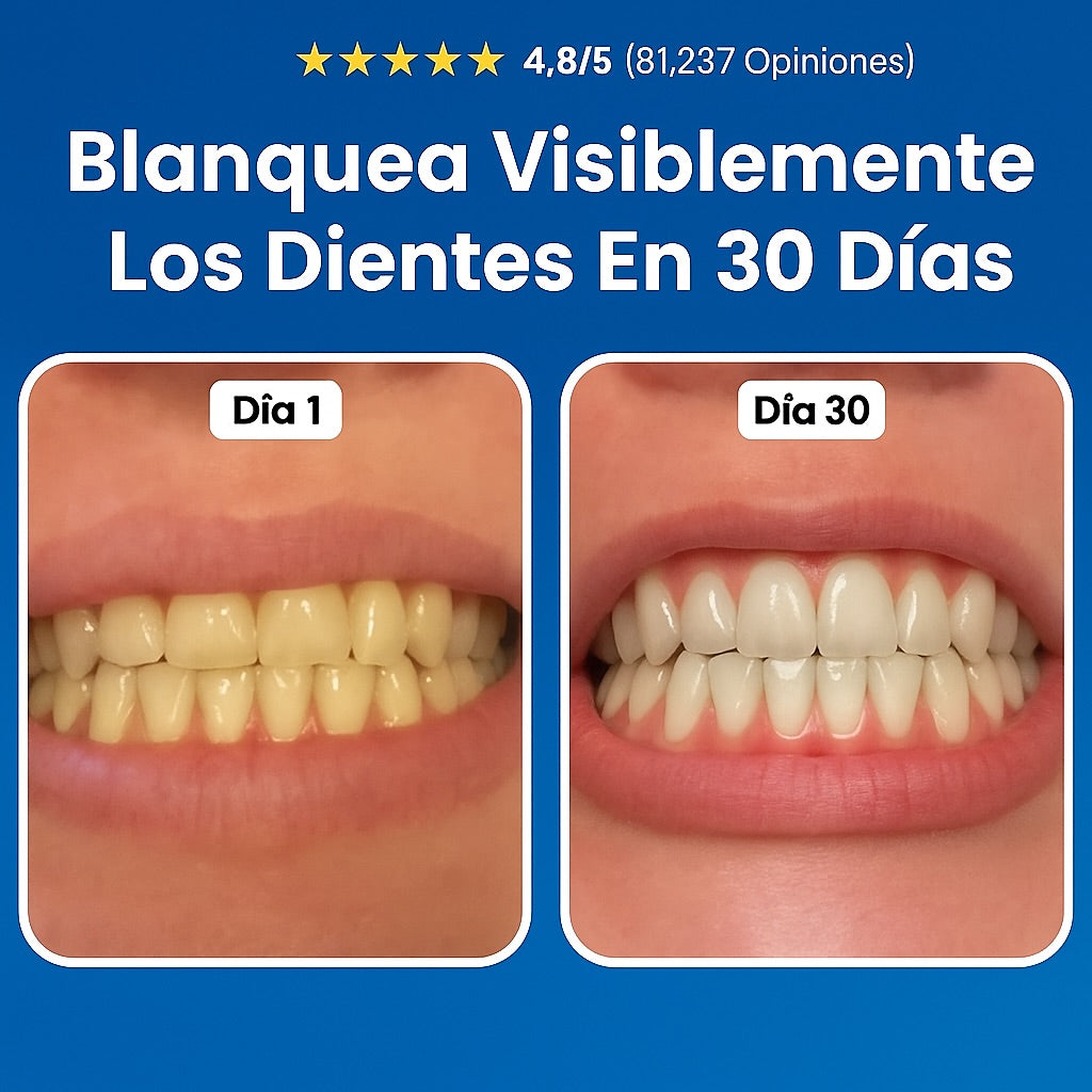 🦷Reparación Dental  Elimina Caries, Placa y Sarro - 🛡️ Escudo Natural restaurador Para Esmalte Avanzado 🦷¡Dile adiós a las caries de forma natural y efectiva!🦷