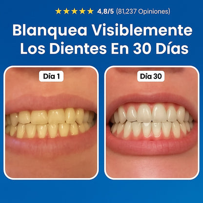 🦷Reparación Dental  Elimina Caries, Placa y Sarro - 🛡️ Escudo Natural restaurador Para Esmalte Avanzado 🦷¡Dile adiós a las caries de forma natural y efectiva!🦷