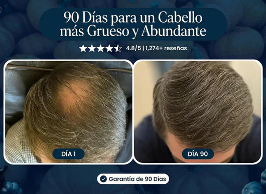 ULTIMAS UNIDADES-✨SHAMPOO EXCALVO REGENERADOR EFICAZ CONTRA LA CALVICIE+ENVIO GRATIS✨